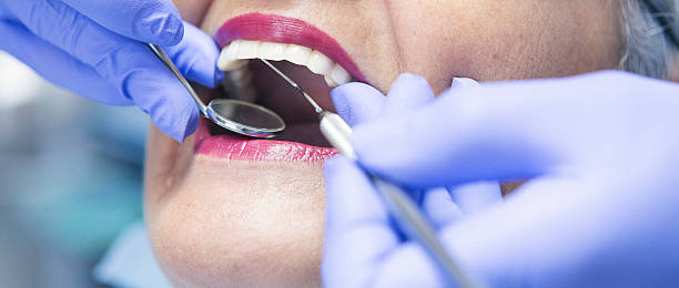 Best Emergency Tooth Extraction in Elmore, AL